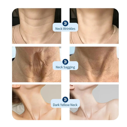 7-in-1 LED Facial and Neck Mask